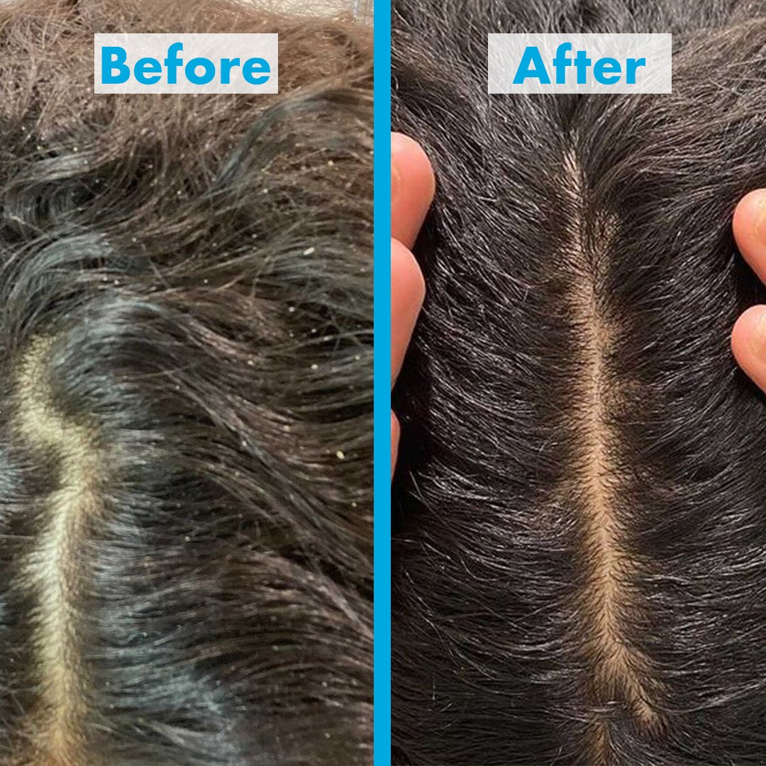 scalp reviving scrub results